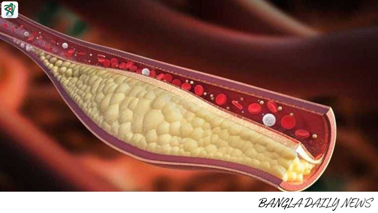 মাত্র ৩০ দিনেই কোলেস্টেরল কমানো সম্ভব! জানুন সহজ ও কার্যকর উপায়